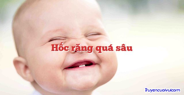 Hốc răng quá sâu 		
