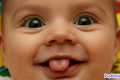 Có thể cưới hai “cái ruột thừa” 		